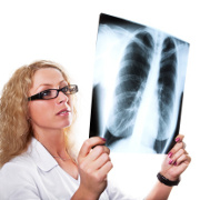 Tuberculosis related image